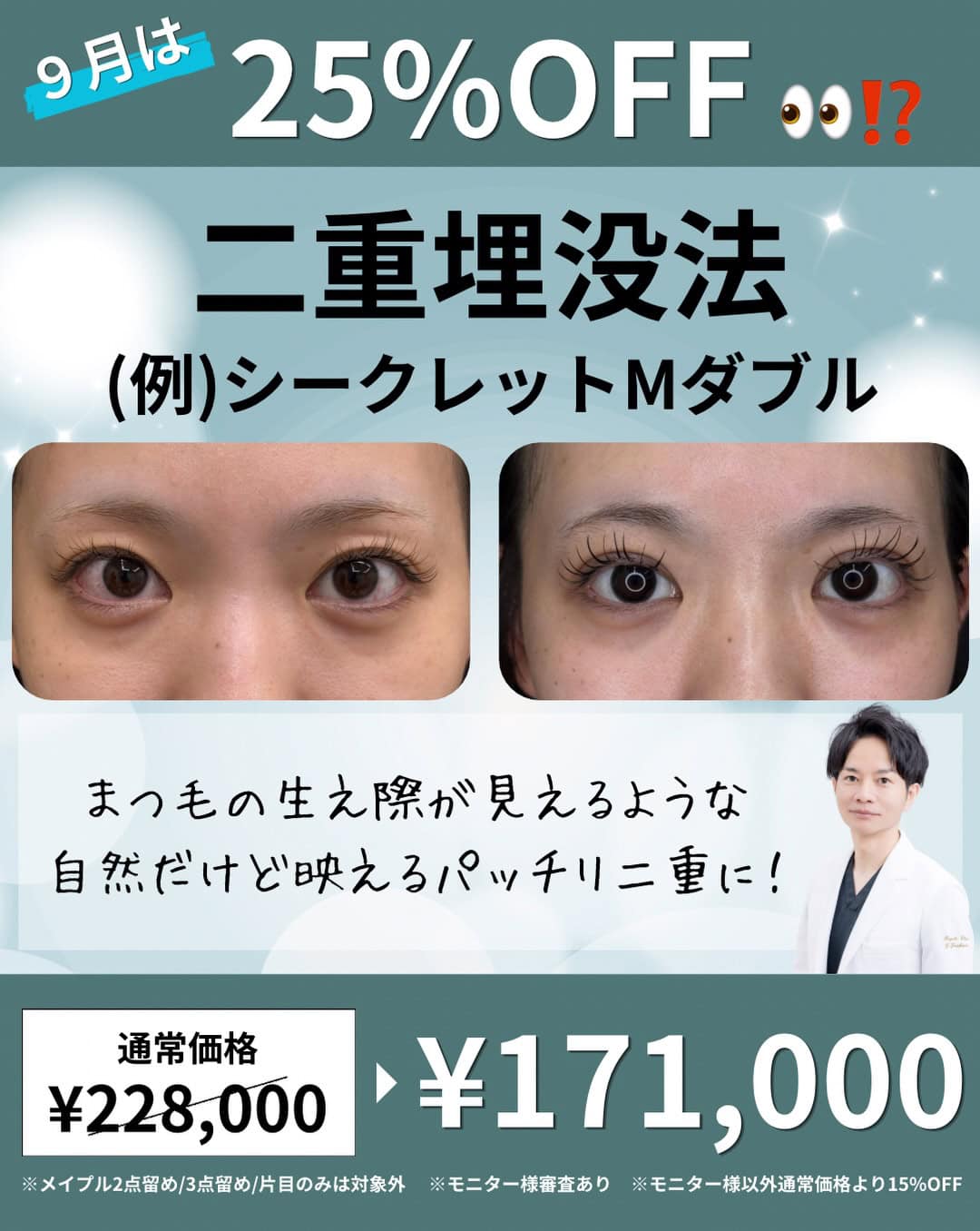 できるだけ自然な仕上がりの二重埋没法のメイン画像