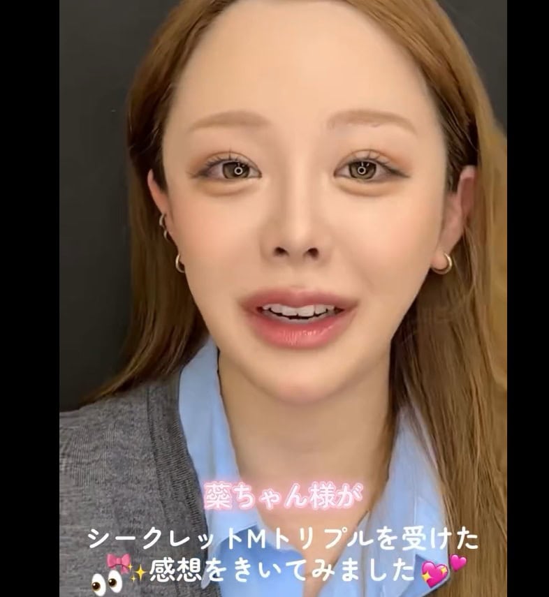埋没法の二重施術でマツエクのデザインも映える！のメイン画像