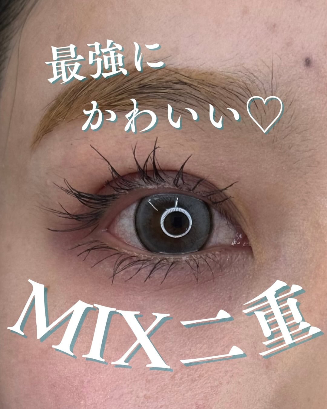 埋没法シークレットシリーズでMIX二重にのメイン画像