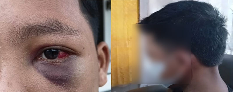 MP, seorang santri di Kabupaten Muaro Jambi, mengaku dianya oleh gurunya | nst