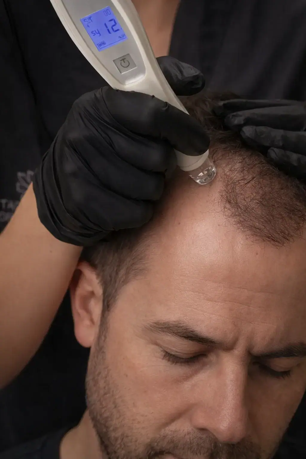 Intensieve haarbehandeling met Tahe T98 Peptide in Apeldoorn