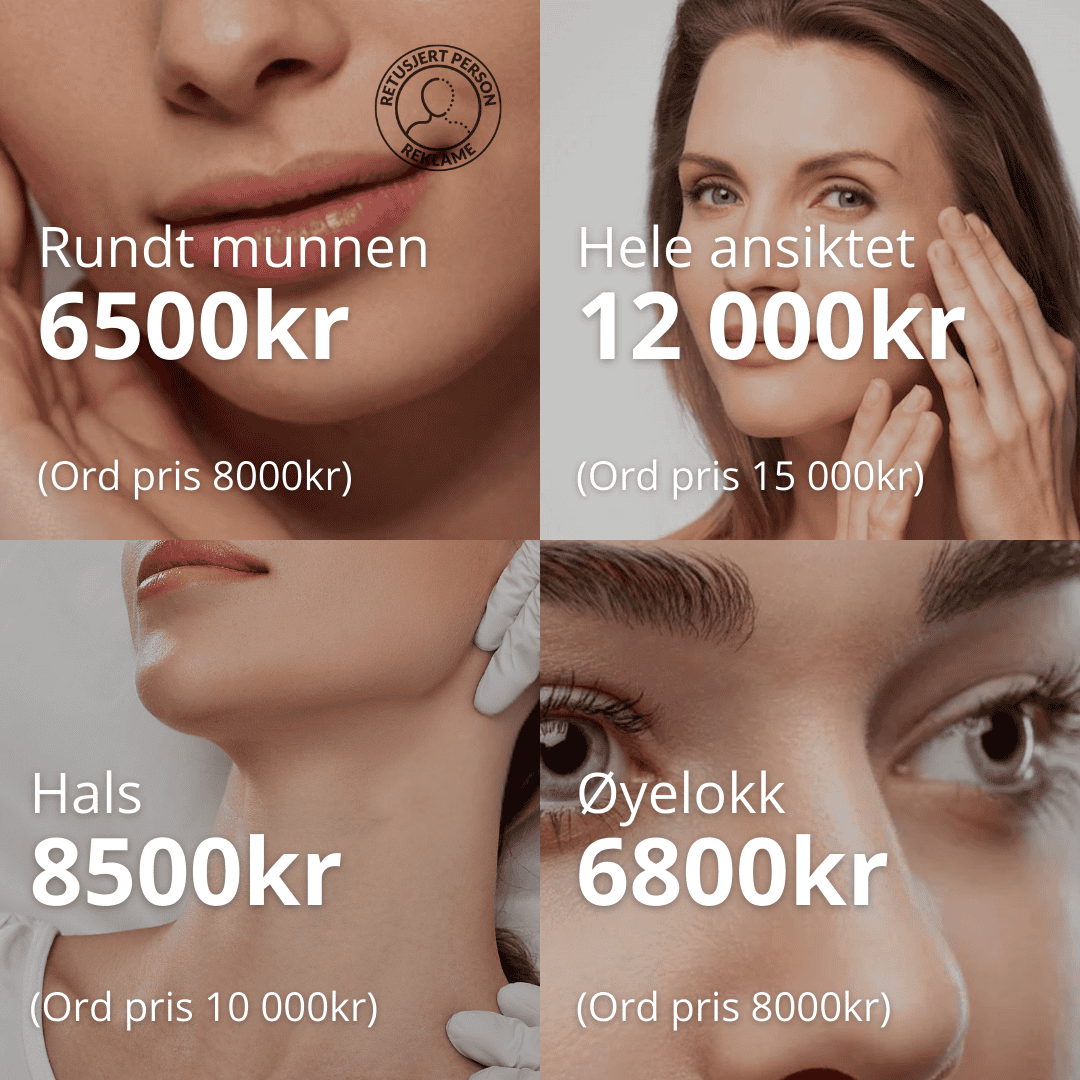 -20% på CO2 laser