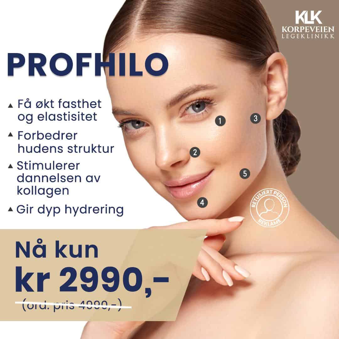 Profilo 40%