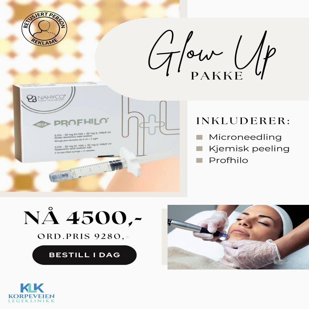 Glow up pakke 4500,-