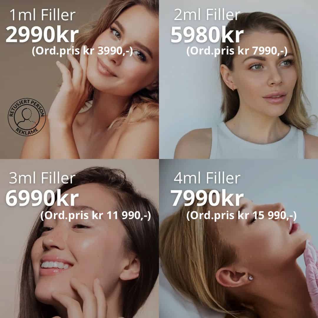 fillers nå intill 40%