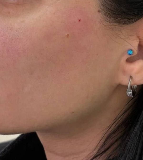 hudfuktighet reusltat