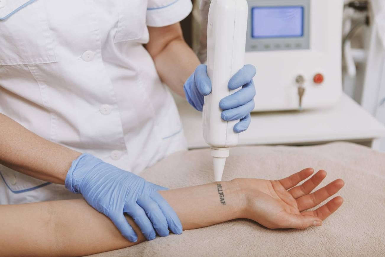 Technician performing laser tattoo removal on forearm at a clinic in Toronto