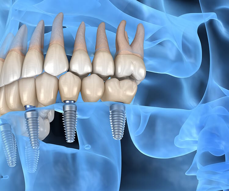 Image gallery marquee