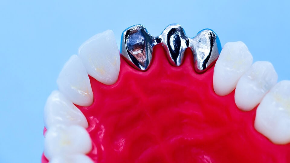 Image gallery marquee