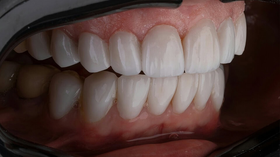 Image gallery marquee