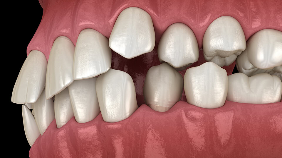 Image gallery marquee