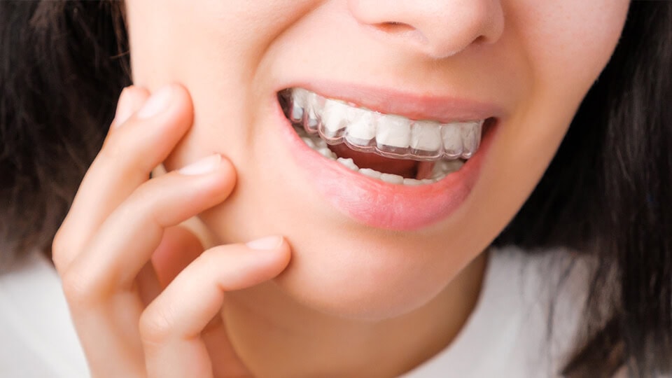 Image gallery marquee