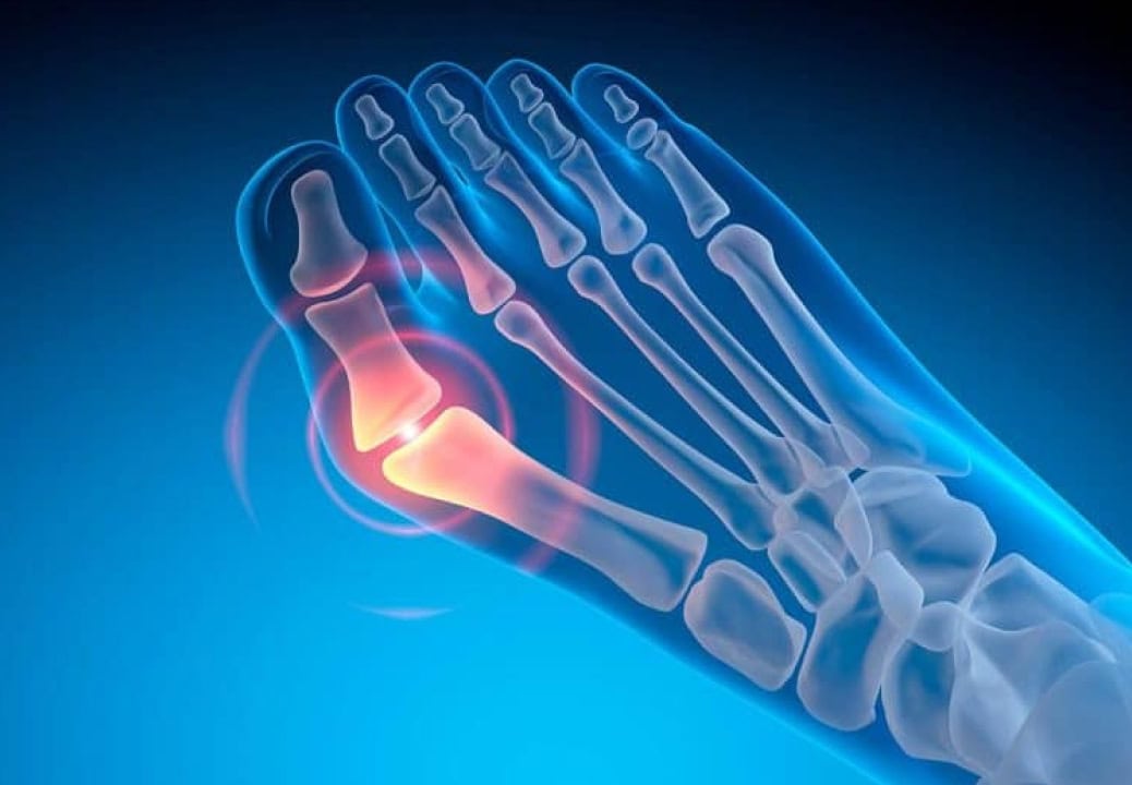 Foot Pain Relief Aberdeen, NJ