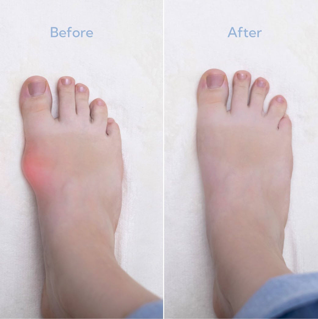 Foot Health Aberdeen, NJ