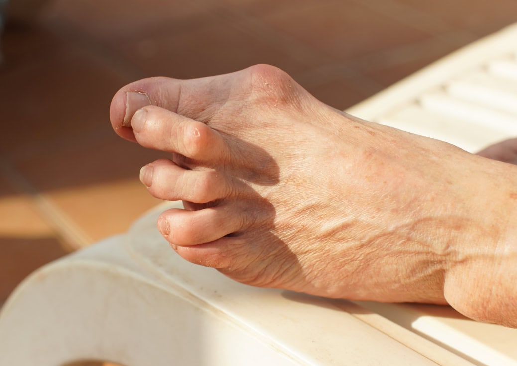 Foot Pain Relief Aberdeen, NJ