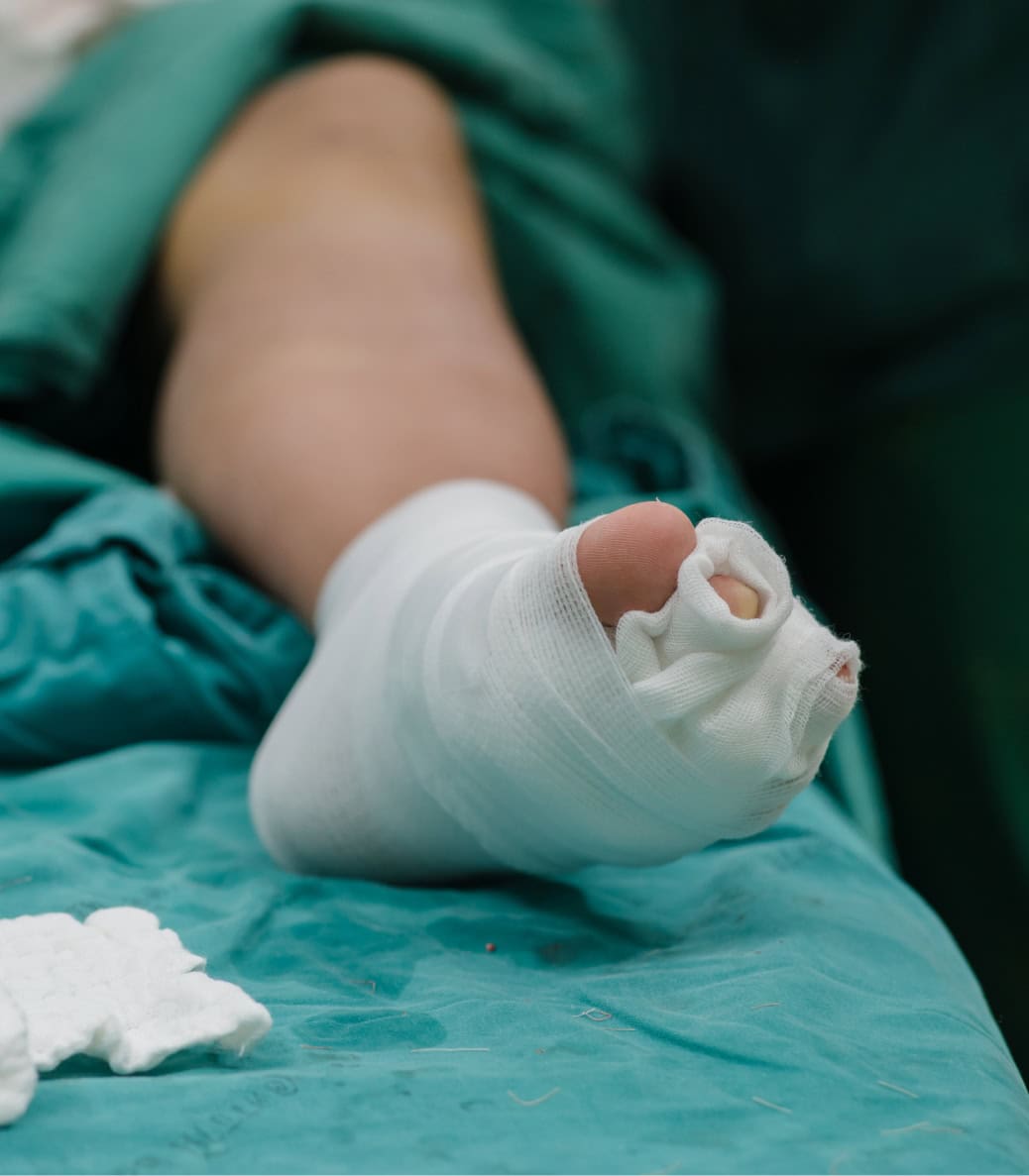 Toe Deformity Correction Farmingdale, NJ