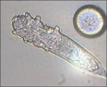 О чем мечтают Ваши глаза, когда Вы сидите за компьютером? 1 Demodex folliculorum