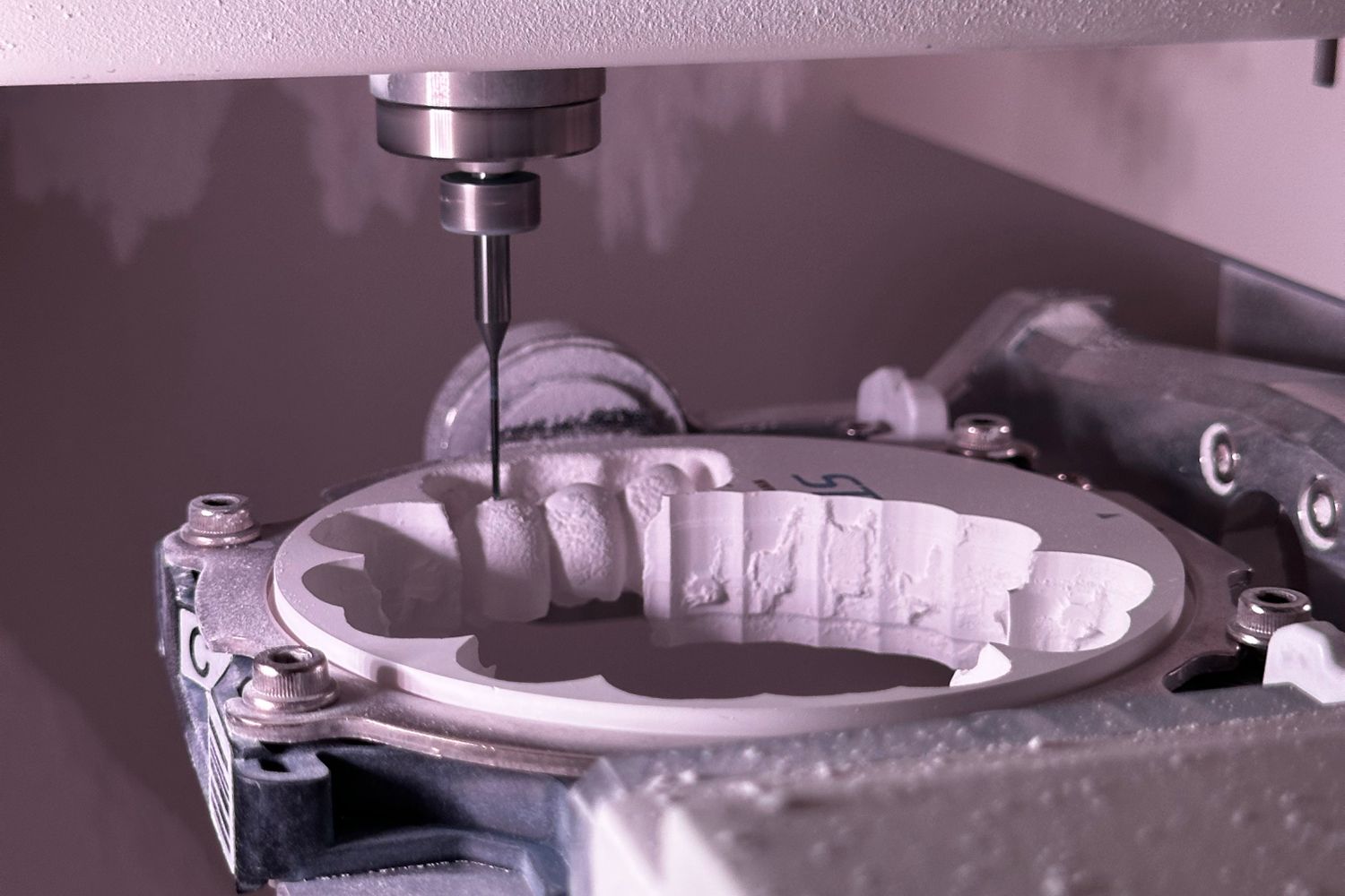 Tecnología CEREC