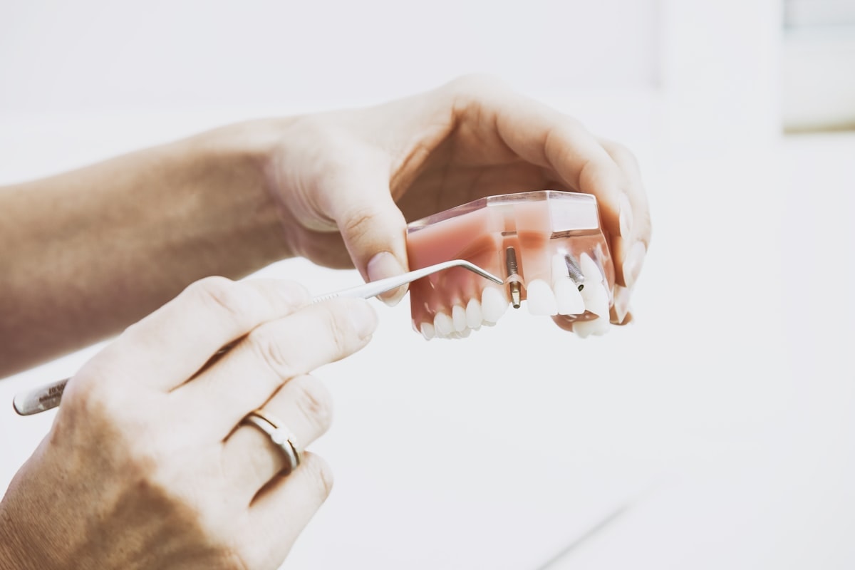 Prótesis dentales