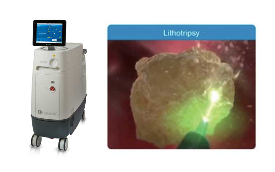 Lumenis Pulse™ 120H