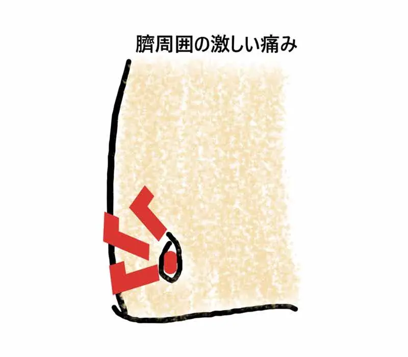臍から膿が出る