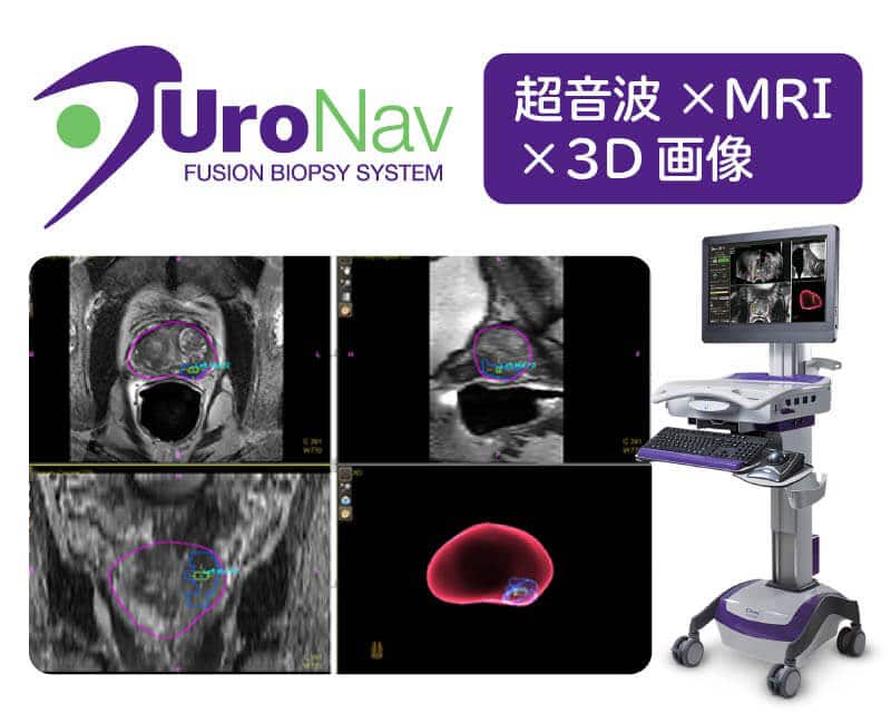 Uronavi(ウロナビ)の特徴