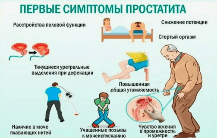 первые симптомы простатита Простатит симптомы