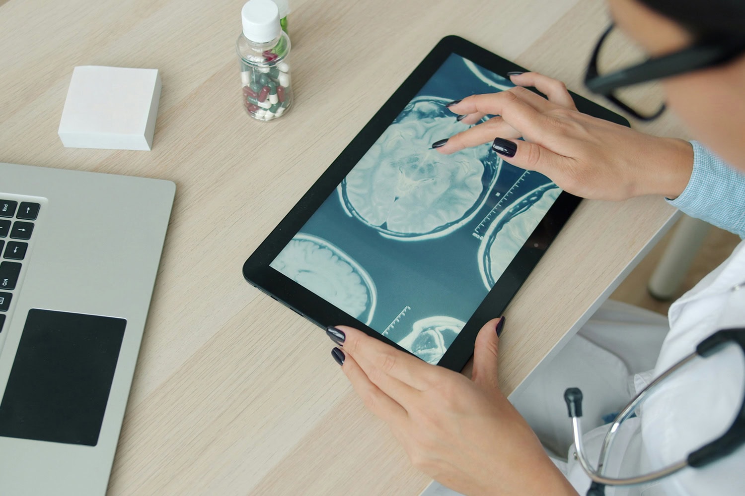 Besivance patient assistance eligibility