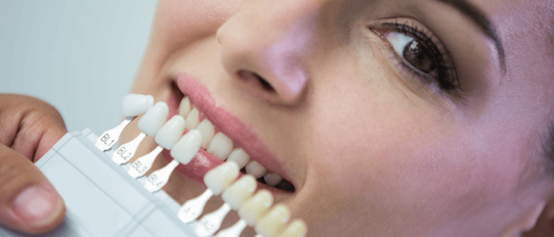 Veneers for Front Teeth Gap: A Simple Way to Transform Your Smile