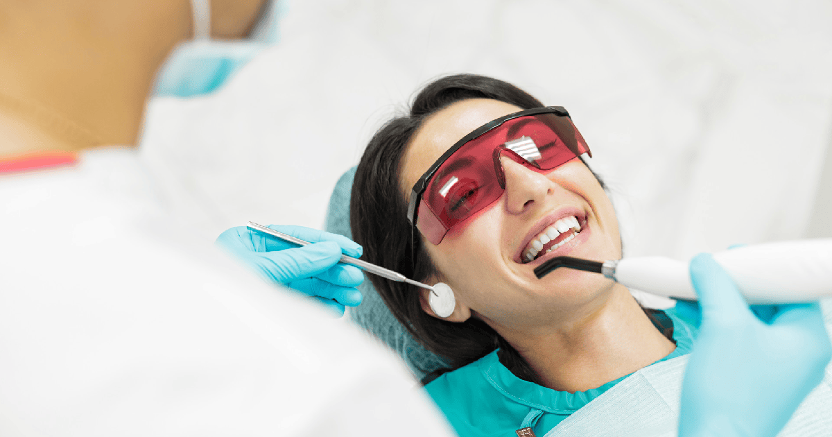 Why Professional Teeth Whitening Services Are Better Than DIY Whitening Kits?