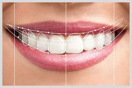 smile makeover in new orleans