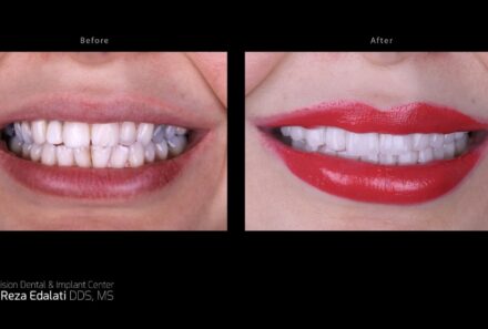 Transform Your Smile with Expert Cosmetic Dentistry Services