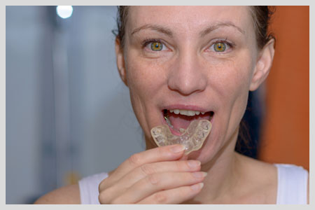 Veneers Cost_images - blyss-dental-veneers-cost-porcelain