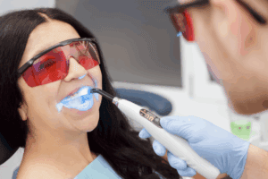 Is Professional Teeth Whitening Safe? Everything You Need to Know About!