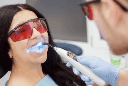 Is Professional Teeth Whitening Safe? Everything You Need to Know About!