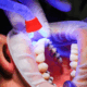 How Long Does Professional Teeth Whitening Last