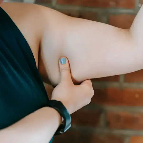 Arm Lift Surgery