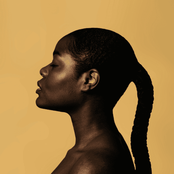 Keloid Treatment