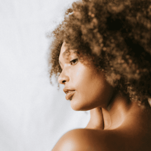 Keloid Treatment