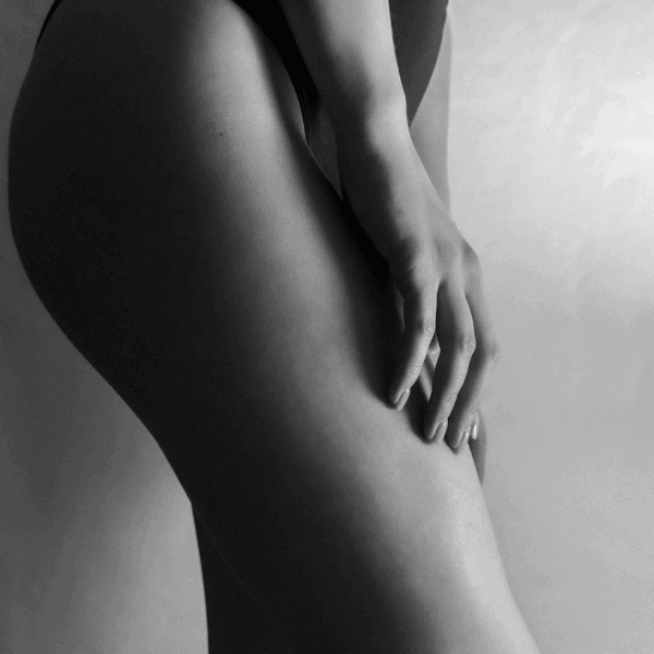 Thigh Lift