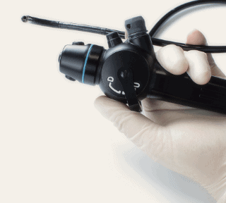 消化管内視鏡検査