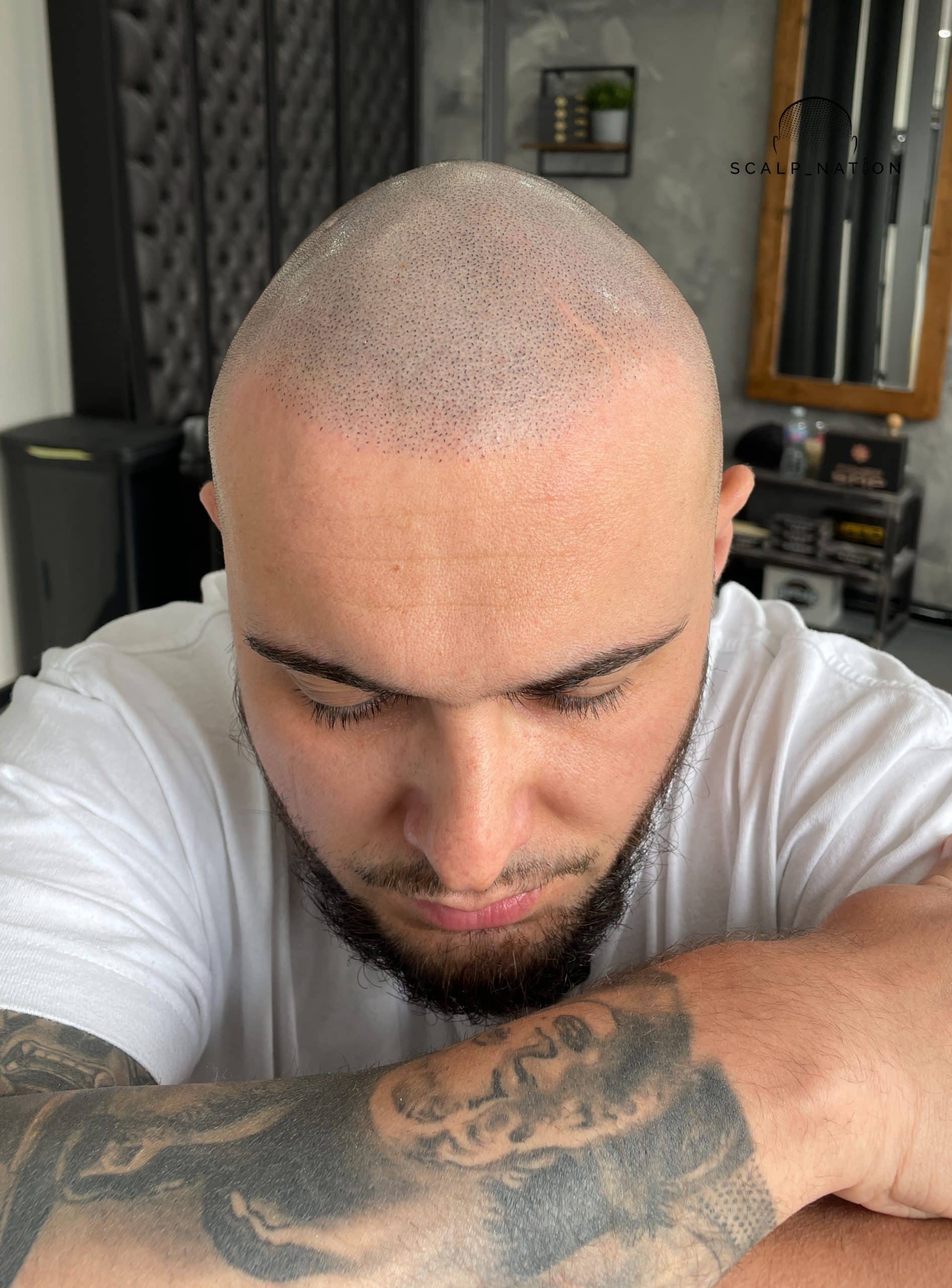 AFTER - Natural Light - Front