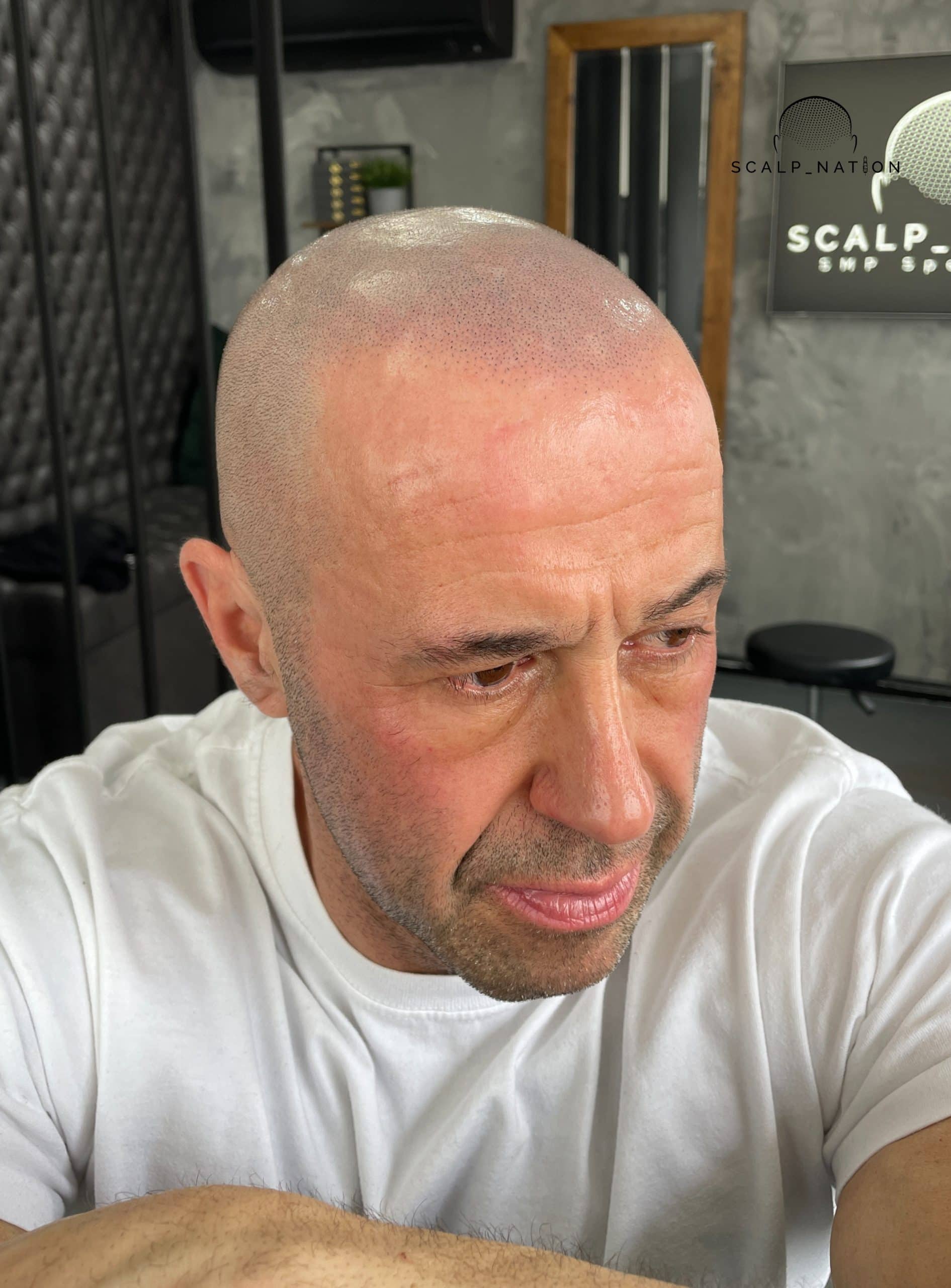 AFTER - Natural Light - Side 2