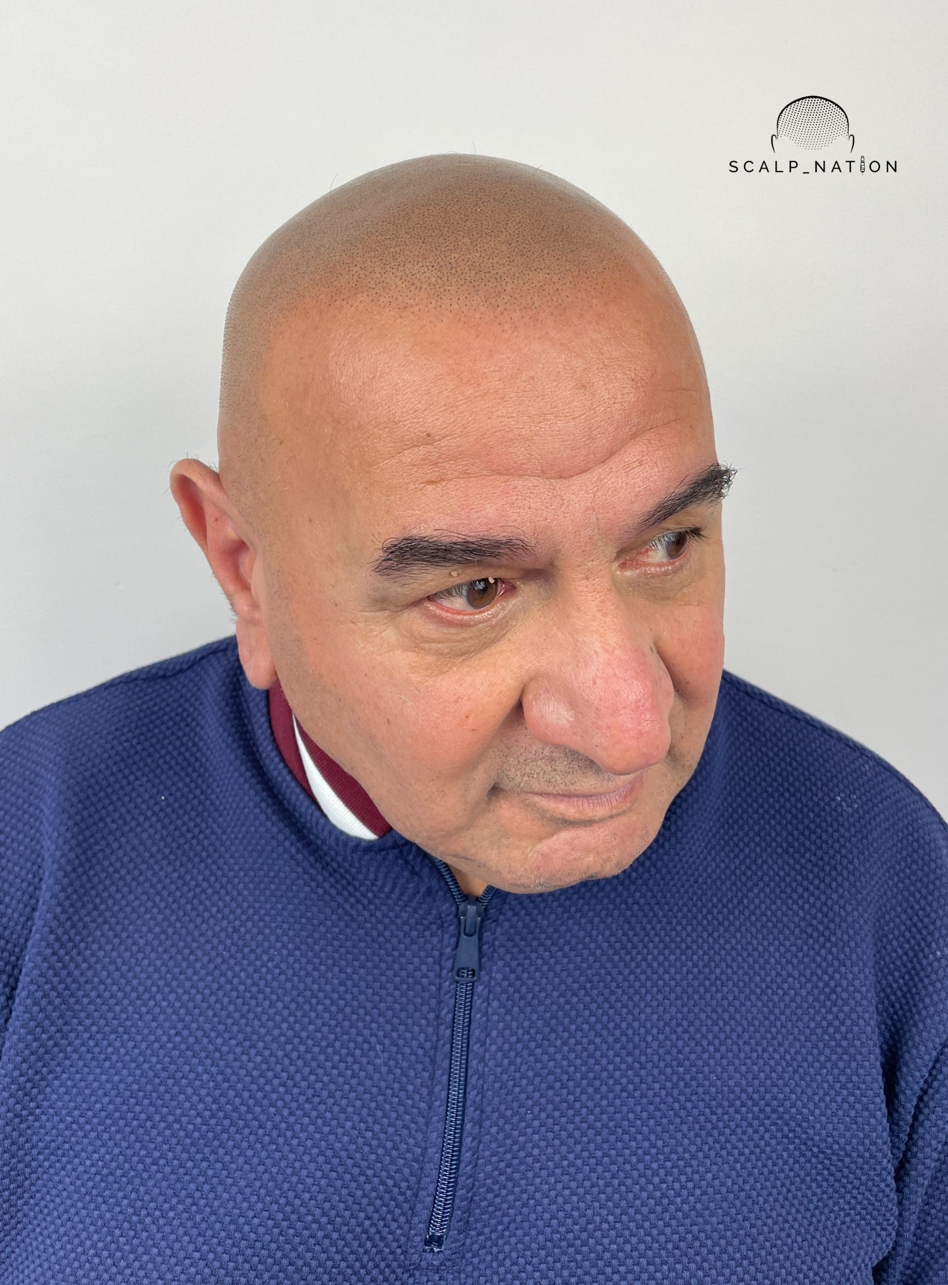 AFTER - Studio Light - Side 2