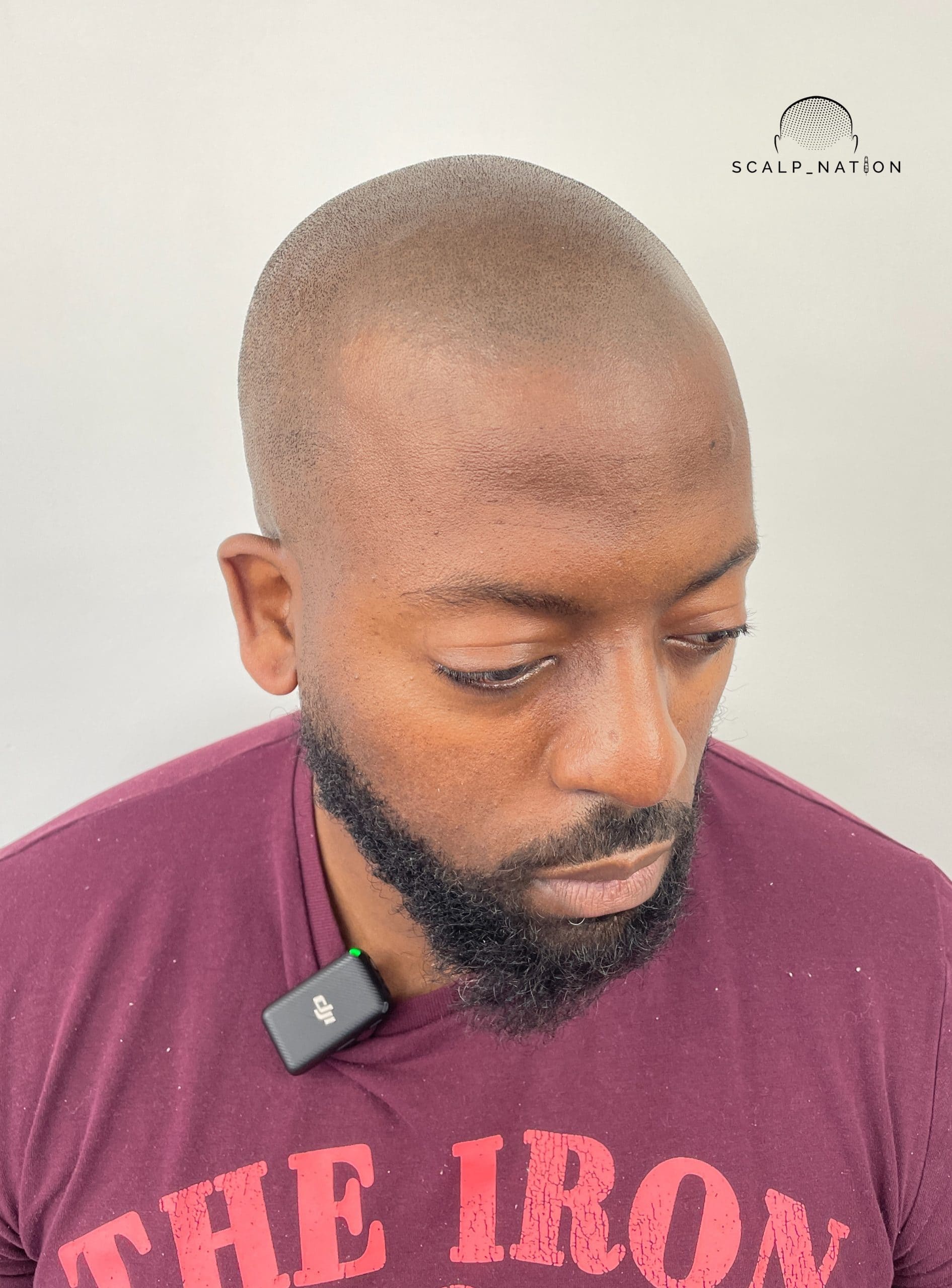 AFTER - Studio Light - Side 2