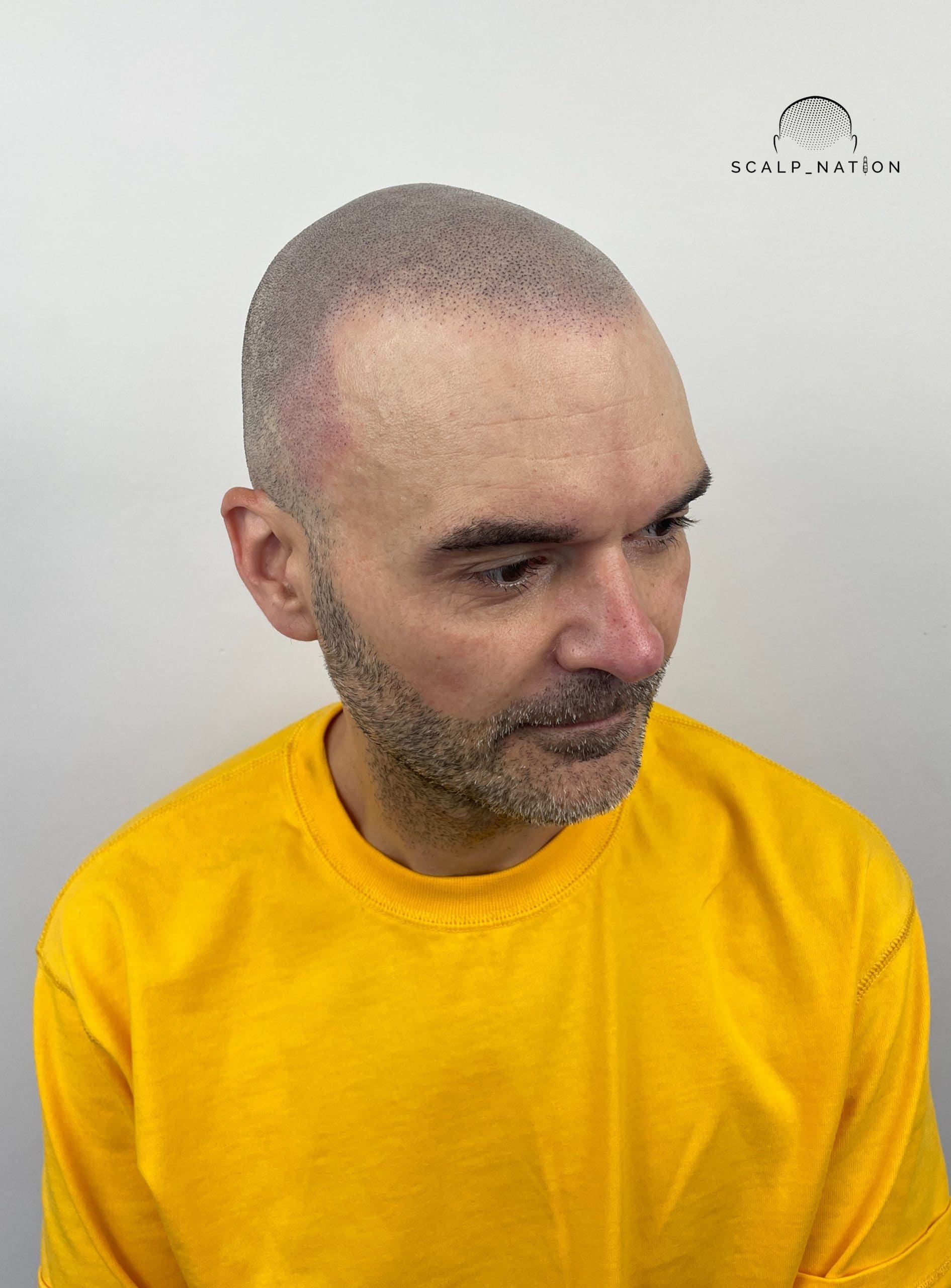 AFTER - Studio Light - Side 2