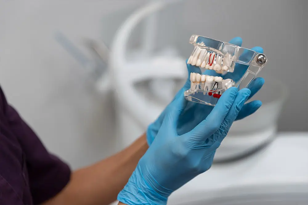 Dental implants