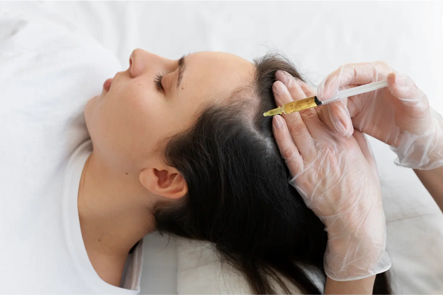Botox & PRP treatment