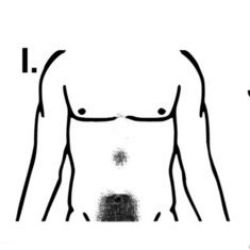 #7