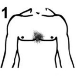 #1